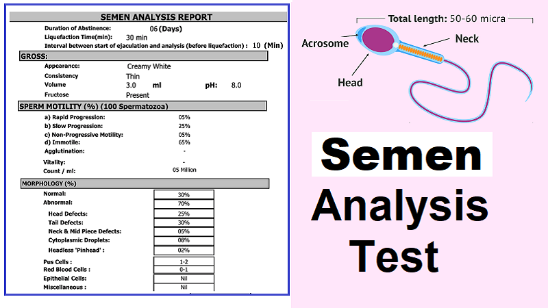 semen analysis procedure