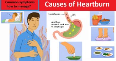 Causes of Heartburn, common symptoms, how to manage?