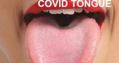 Symptoms of Covid-19 , What are the new ones reported recently?