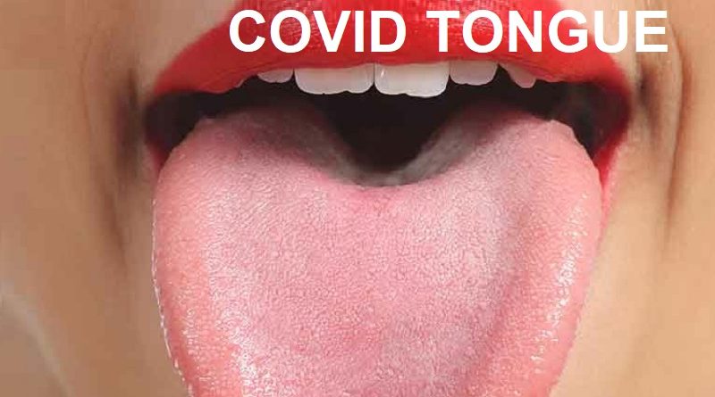 Symptoms of Covid-19 , What are the new ones reported recently?