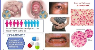 gonorrhea facts