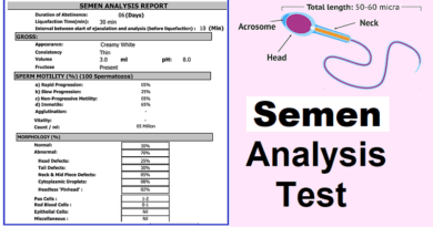Semen analysis test, made easy to understand