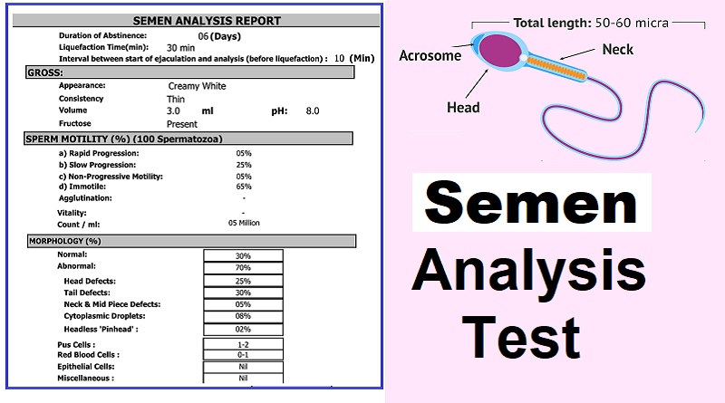 Semen analysis test, made easy to understand
