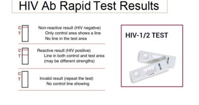 HIV testing Antibody test