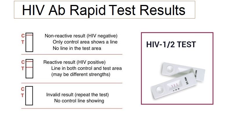 HIV testing Antibody test