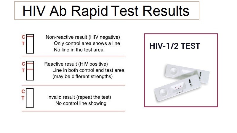 elisa and western blot test for hiv locations