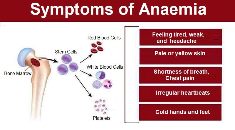 Symptoms of Anaemia, what are the types and Causes?