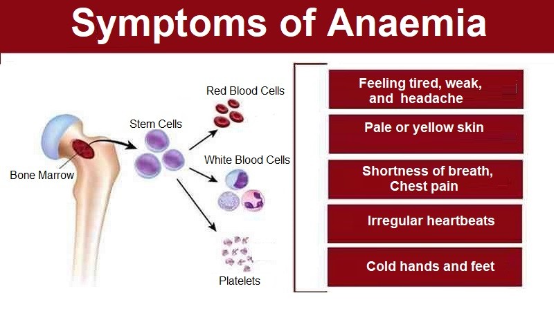 symptoms-of-anaemia-what-are-the-types-and-causes-helal-medical