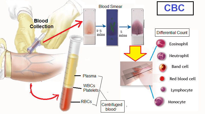 Complete Blood Count Test - CBC