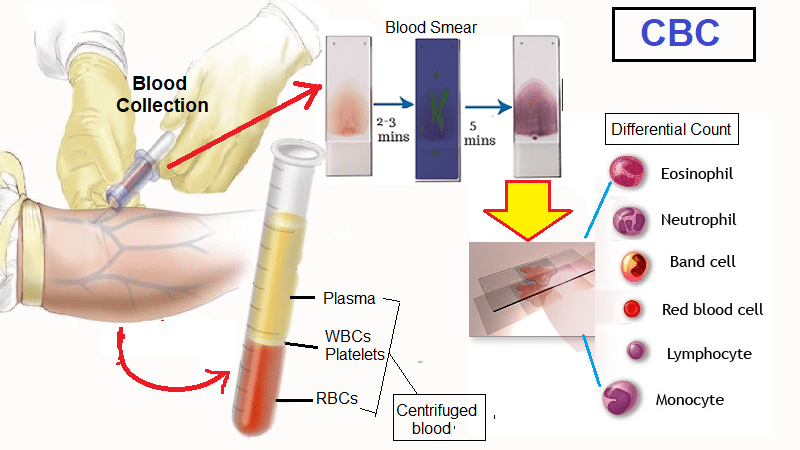 Complete Blood Count CBC Normal Values Helal Medical