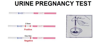 Urine Pregnancy Test