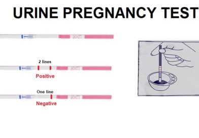 Urine Pregnancy Test