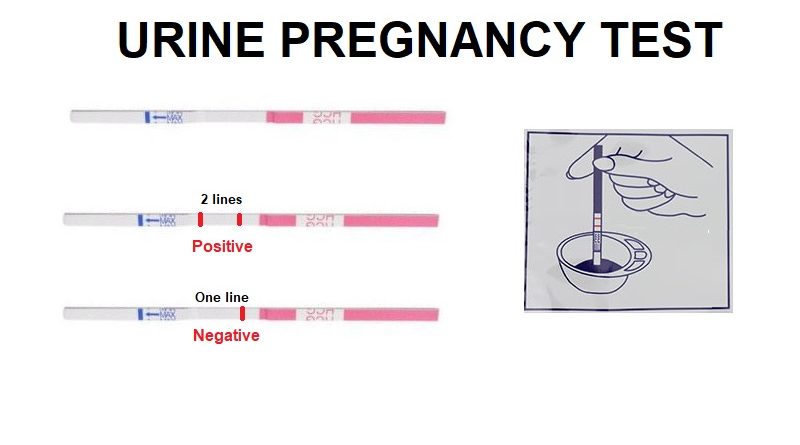Urine Pregnancy Test