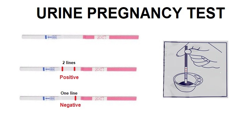 Urine Pregnancy Test How And When To Do Helal Medical 