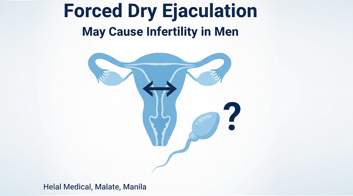 Forced Dry Ejaculation May Cause Infertility in Men