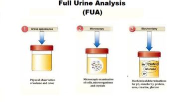 Full Urine Analysis (FUA) , indications
