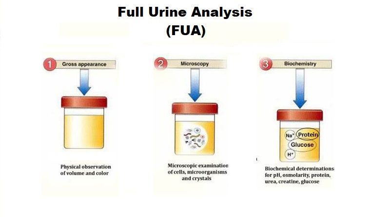 Full Urine Analysis (FUA) , indications