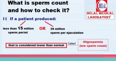 Male infertility causes and semen Frequently Asked Questions