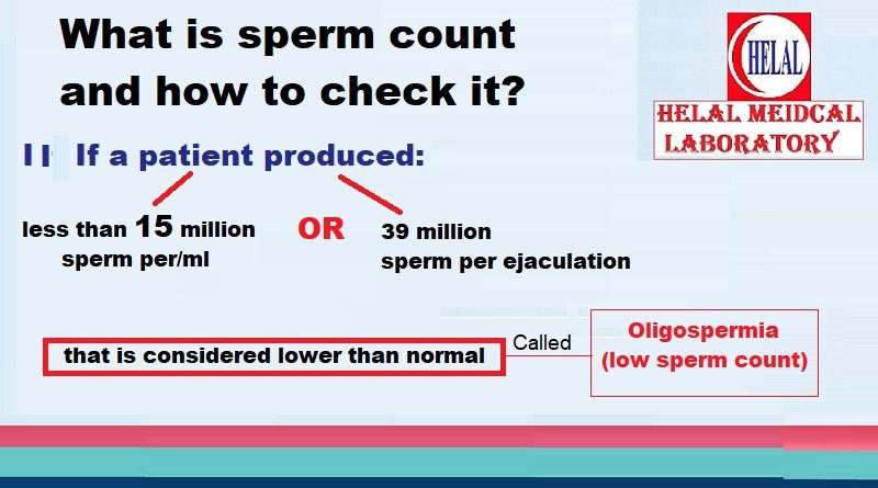 Male infertility causes and semen Frequently Asked Questions