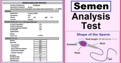 semen analysis - Sperm count