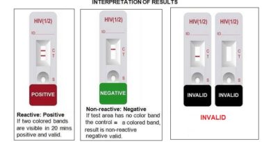 HIV Home Test