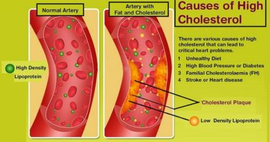Increase in Cholesterol, Factors That May Cause it?
