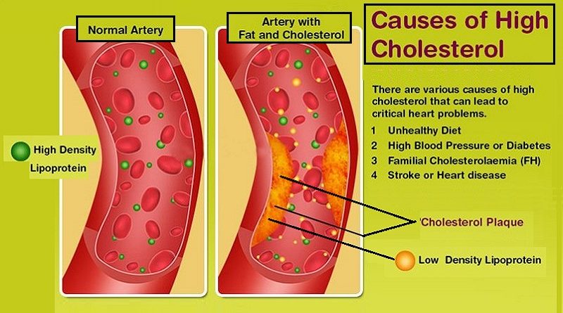 Increase in Cholesterol, Factors That May Cause it?