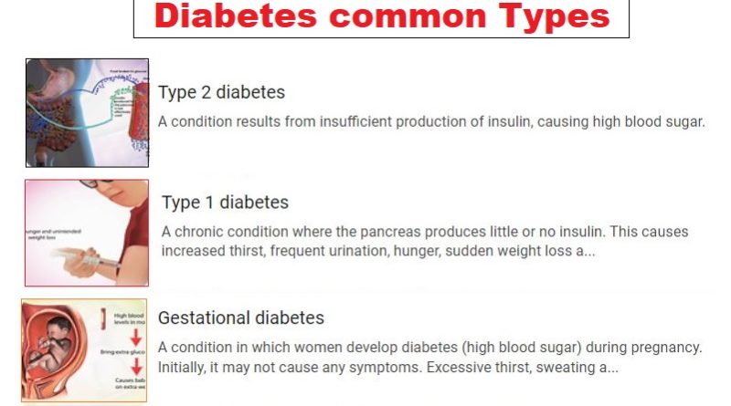 Diabetes Types, symptoms, complications and management