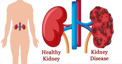 Kidney Diseases , Types and Diagnosis