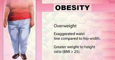 OBESITY