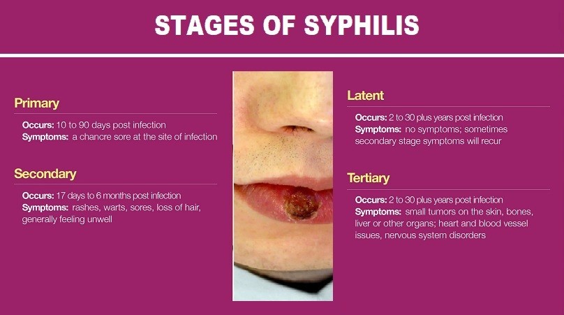 Syphilis Infection, Symptoms And Stages - Helal Medical