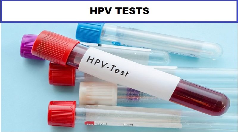 HPV tests: A Guide to Screening and Prevention