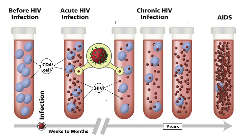 Stages from Acute HIV Infection to AIDS