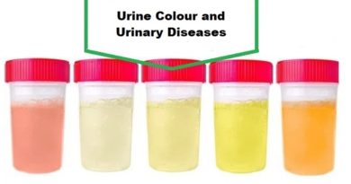 Urine Color: What Does It Mean?