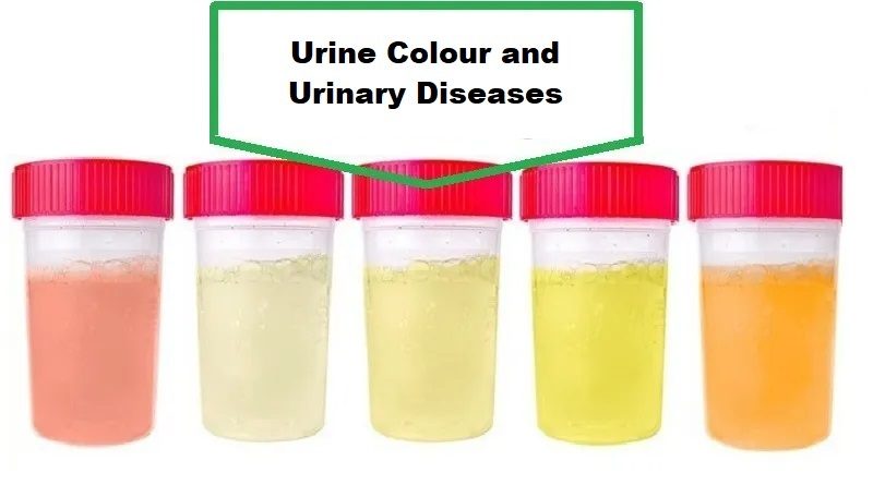 Urine Color: What Does It Mean?
