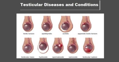 Introduction to Testicles and Testicular Diseases