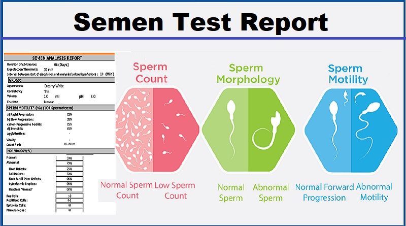 Semen analysis: How to understand the report and What the normal values are