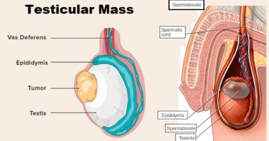 Testicular Mass: What You Need to Know