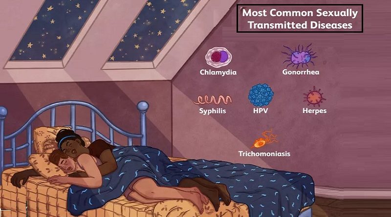 10 Most Popular STDs Questions, you need to know