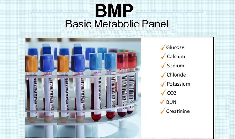 Basic Metabolic Panel (BMP)