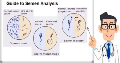 Semen Analysis, Procedure