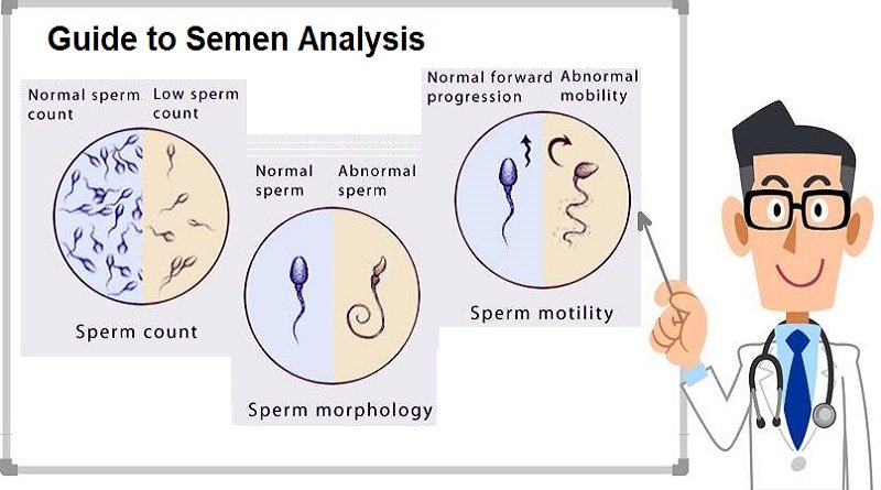 Semen Analysis, Procedure