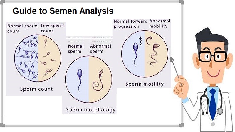 A Guide To Semen Analysis Helal Medical