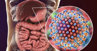 Hepatitis C Virus: Symptoms, Diagnosis, and Treatment