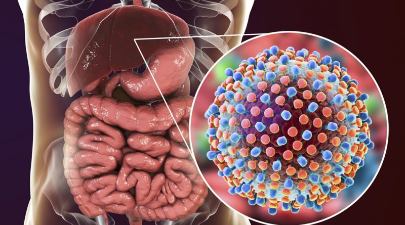 Hepatitis C Virus: Symptoms, Diagnosis, and Treatment