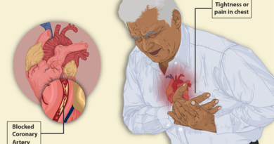 Understanding angina