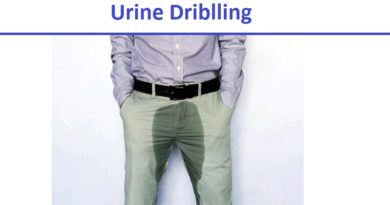 Urine Dribbling, Causes and Treatment