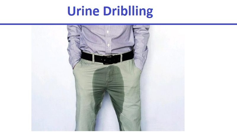 Urine Dribbling, Causes and Treatment