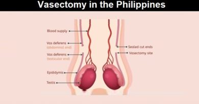 Vasectomy in the Philippines