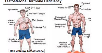 Testosterone Hormone Deficiency: Causes, Symptoms and Treatment